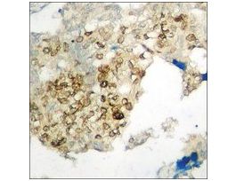 Anti-phospho-CaMK1-alpha (pThr177) antibody produced in rabbit~1 mg/mL, affinity isolated antibody, buffered aqueous solution