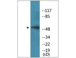 Anti-phospho-CaMK4 (pThr196/200) antibody produced in rabbit~1 mg/mL, affinity isolated antibody, buffered aqueous solution