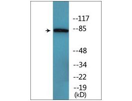 Anti-phospho-CD71/TfR (pSer24) antibody produced in rabbit~1 mg/mL, affinity isolated antibody, buffered aqueous solution