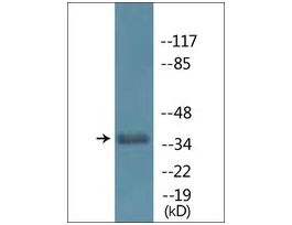 Anti-phospho-Cyclin H (pThr315) antibody produced in rabbit~1 mg/mL, affinity isolated antibody, buffered aqueous solution