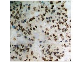 Anti-phospho-Catenin-delta1 (pTyr228) antibody produced in rabbit~1 mg/mL, affinity isolated antibody, buffered aqueous solution