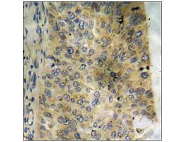 Anti-phospho-CRYAB/Crystallin-alpha-B (pSer59) antibody produced in rabbit~1 mg/mL, affinity isolated antibody, buffered aqueous solution