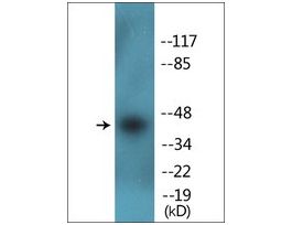 Anti-phospho-CDK9 (pThr186) antibody produced in rabbit~1 mg/mL, affinity isolated antibody, buffered aqueous solution