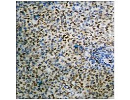 Anti-phospho-SSB (pSer366) antibody produced in rabbit~1 mg/mL, affinity isolated antibody, buffered aqueous solution