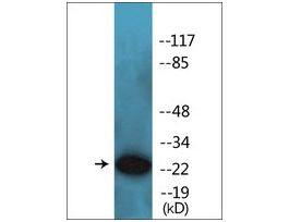 Anti-phospho-ARHGDIA (pSer174) antibody produced in rabbit~1 mg/mL, affinity isolated antibody, buffered aqueous solution