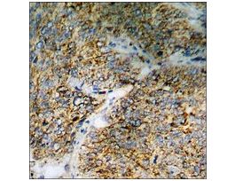 Anti-phospho-ASK1 (pSer83) antibody produced in rabbit~1 mg/mL, affinity isolated antibody, buffered aqueous solution