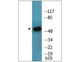 Anti-phospho-ATF2 (pSer112 or 94) antibody produced in rabbit~1 mg/mL, affinity isolated antibody, buffered aqueous solution