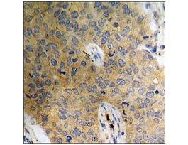 Anti-phospho-Catenin-beta (pSer37) antibody produced in rabbit~1 mg/mL, affinity isolated antibody, buffered aqueous solution