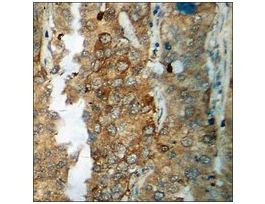 Anti-phospho-Catenin-beta (pThr41/Ser45) antibody produced in rabbit~1 mg/mL, affinity isolated antibody, buffered aqueous solution