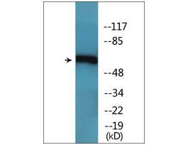 Anti-phospho-Chk2 (pThr68) antibody produced in rabbit~1 mg/mL, affinity isolated antibody, buffered aqueous solution