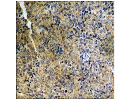 Anti-phospho-Cofilin (pSer3) antibody produced in rabbit~1 mg/mL, affinity isolated antibody, buffered aqueous solution