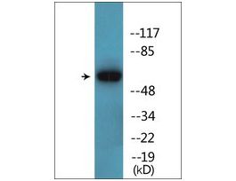 Anti-phospho-Cortactin (pTyr466) antibody produced in rabbit~1 mg/mL, affinity isolated antibody, buffered aqueous solution