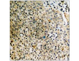 Anti-phospho-Dab1 (pTyr232) antibody produced in rabbit~1 mg/mL, affinity isolated antibody, buffered aqueous solution