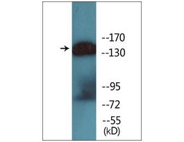 Anti-phospho-HER2 (pTyr1221/Tyr1222) antibody produced in rabbit~1 mg/mL, affinity isolated antibody, buffered aqueous solution