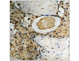Anti-phospho-p73 (pTyr99) antibody produced in rabbit~1 mg/mL, affinity isolated antibody, buffered aqueous solution