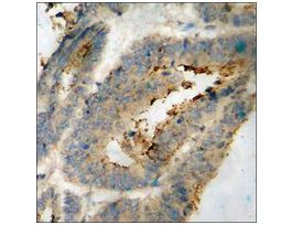 Anti-phospho-PDGF Receptor beta (pTyr751) antibody produced in rabbit~1 mg/mL, affinity isolated antibody, buffered aqueous solution