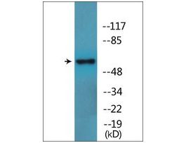 Anti-phospho-LCK (pSer59) antibody produced in rabbit~1 mg/mL, affinity isolated antibody, buffered aqueous solution