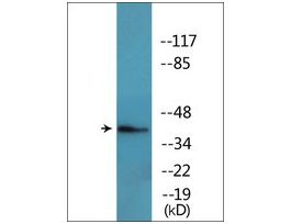 Anti-phospho-FOS (pThr232) antibody produced in rabbit~1 mg/mL, affinity isolated antibody, buffered aqueous solution