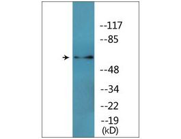 Anti-phospho-CRMP-2 (pThr509) antibody produced in rabbit~1 mg/mL, affinity isolated antibody, buffered aqueous solution