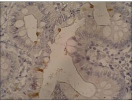 Monoclonal Anti-Sialyl Lewis a antibody produced in mouseclone 121SLE, purified immunoglobulin, buffered aqueous solution