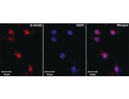 Monoclonal Anti-DNA/RNA Damage antibody produced in mouseclone 15A3, 1 mg/mL, purified immunoglobulin