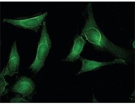 Monoclonal Anti-AHSA1 antibody produced in mouseclone 25F2.D10, 1 mg/mL, purified immunoglobulin