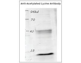 Anti-Acetylated Lysine antibody produced in rabbit1 mg/mL, affinity isolated antibody