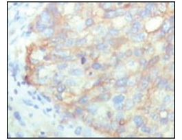 Monoclonal Anti-KARS antibody produced in mouseclone 8G12C1, ascites fluid, buffered aqueous solution