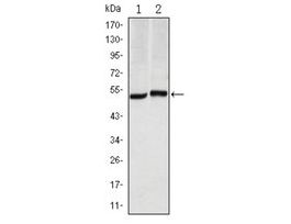 Monoclonal Anti-CA9 antibody produced in mouseclone 2D3, ascites fluid, buffered aqueous solution