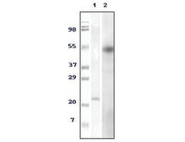 Monoclonal Anti-FOXP3 antibody produced in mouseclone 2A11G9, ascites fluid, buffered aqueous solution