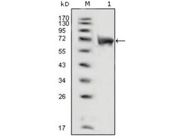 Monoclonal Anti-FGFR1 antibody produced in mouseclone 3D4F7, ascites fluid, buffered aqueous solution
