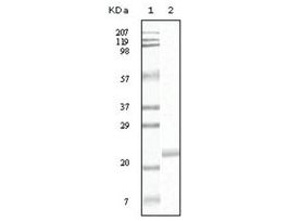 Monoclonal Anti-EPHB4 antibody produced in mouseclone 5B8F7, ascites fluid, buffered aqueous solution