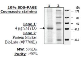 SMYD3 (full length) Active humanrecombinant, expressed in baculovirus infected insect cells, >=50% (SDS-PAGE)