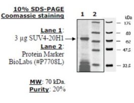 SUV4-20H1 humanrecombinant, expressed in E. coli, >=20% (SDS-PAGE)