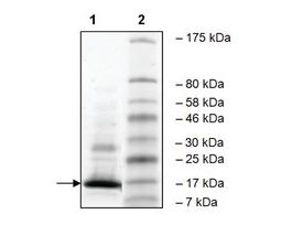 WDR9 (1308-1436) humanrecombinant, expressed in E. coli, >=82% (SDS-PAGE)