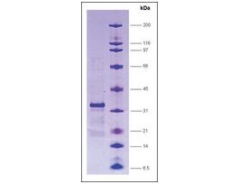 GAL4 [(1-147) + VP16 (411-490)] from Saccharomyces cerevisiae human herpesvirus 2recombinant, expressed in E. coli, >=80% (SDS-PAGE)
