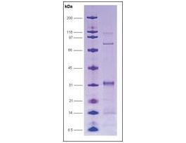 GAL4 [(1-147) + E1A (121-223)] from Saccharomyces cerevisiae canine adenovirusrecombinant, expressed in E. coli, >=70% (SDS-PAGE)