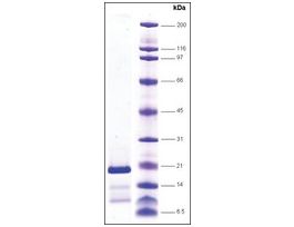 Topo I (C651-765) (C terminal domain) humanrecombinant, expressed in insect cells, >=80% (SDS-PAGE)