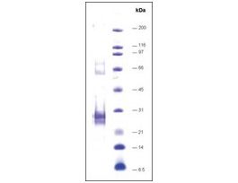 LXRalpha-ligand binding domain (215-667) humanrecombinant, expressed in E. coli, >=70% (SDS-PAGE)
