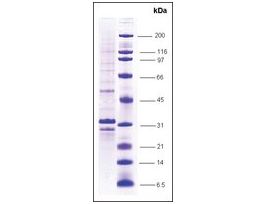 VHL humanrecombinant, expressed in insect cells, >=70% (SDS-PAGE)
