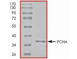 PCNA, His tagged humanrecombinant, expressed in E. coli, >=70% (SDS-PAGE), buffered aqueous glycerol solution