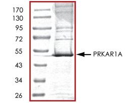 PRKAR1A, His tagged humanrecombinant, expressed in baculovirus infected Sf9 cells, >=70% (SDS-PAGE), buffered aqueous glycerol solution
