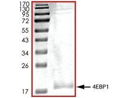 4EBP1, His tagged humanrecombinant, expressed in baculovirus infected Sf9 cells, >=70% (SDS-PAGE), buffered aqueous glycerol solution