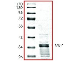 MBP, GST tagged humanrecombinant, expressed in E. coli, >=65% (SDS-PAGE), buffered aqueous glycerol solution