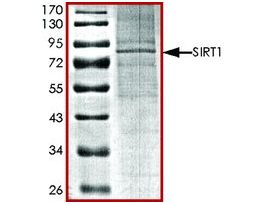 SIRT1, active, His tagged humanrecombinant, expressed in baculovirus infected Sf9 cells, >=70% (SDS-PAGE), buffered aqueous glycerol solution