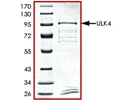 ULK4, GST tagged humanrecombinant, expressed in baculovirus infected Sf9 cells, >=70% (SDS-PAGE), buffered aqueous glycerol solution