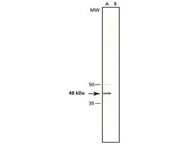 Anti-gamma-Tubulin (QG-17) antibody produced in rabbitaffinity isolated antibody, buffered aqueous solution