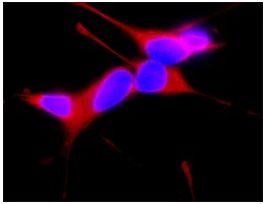 Anti-beta-Tubulin III antibody produced in rabbitaffinity isolated antibody, buffered aqueous solution