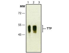 Anti-TTP (C-terminal) antibody produced in rabbit~1.0 mg/mL, affinity isolated antibody, buffered aqueous solution