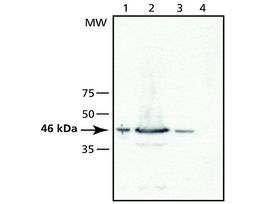 Anti-TSG101 (N-terminal) antibody produced in rabbit~1 mg/mL, affinity isolated antibody, buffered aqueous solution